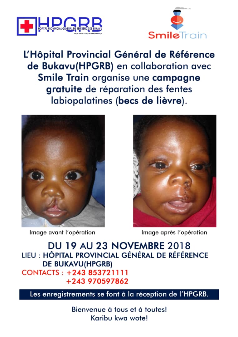 Bukavu : la campagne de réparation des fentes labiales sera lancée le 19 novembre prochain